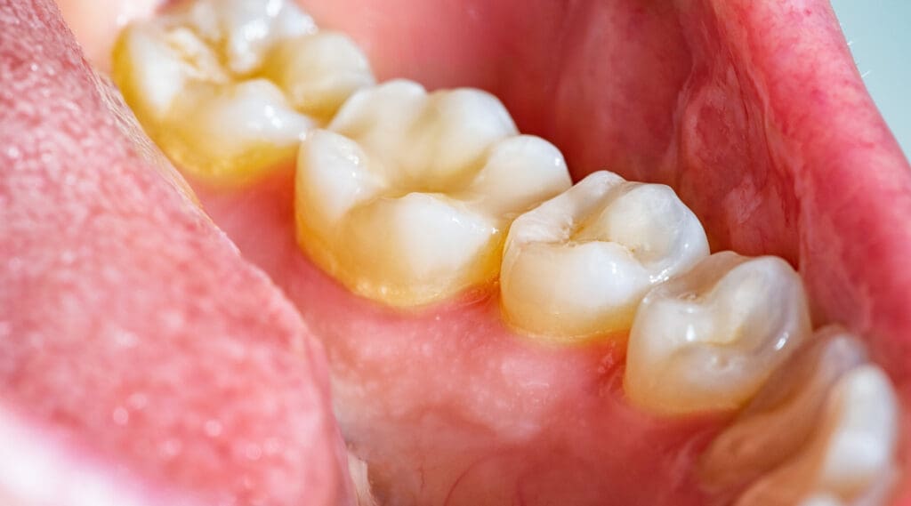 Oral Pathology & Diagnosis Oral Pathology & Diagnosis