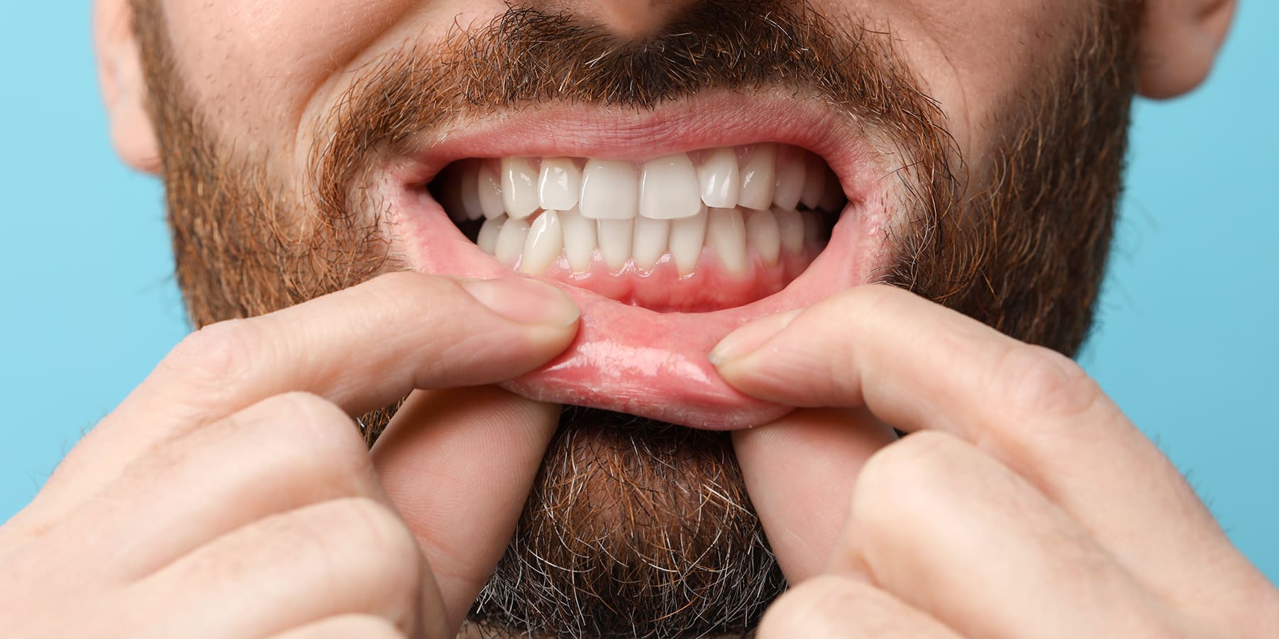 Can Oral Bone Spurs Go Away on Their Own?