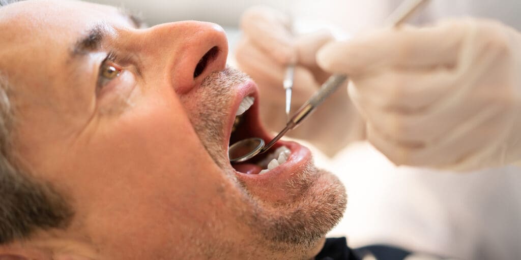 The Most Common Causes of White Patches in the Mouth