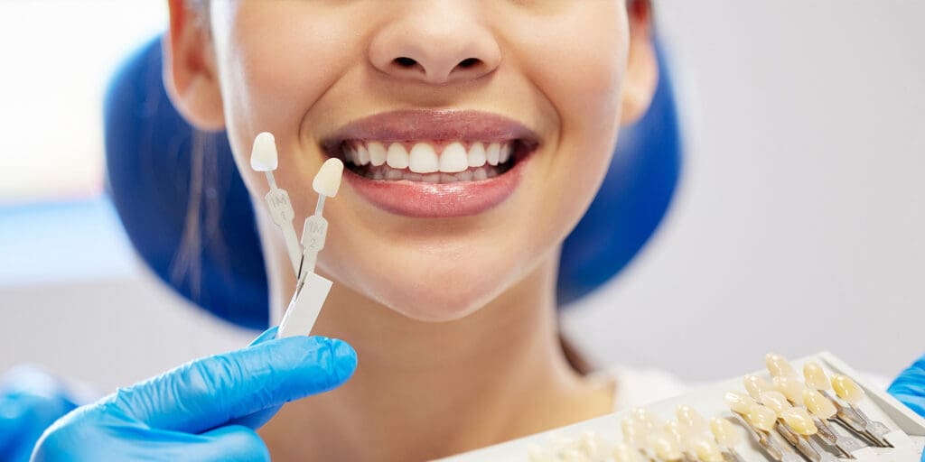 Single Tooth Implant Cost in Canada: What Dental Implants Cost in Ontario