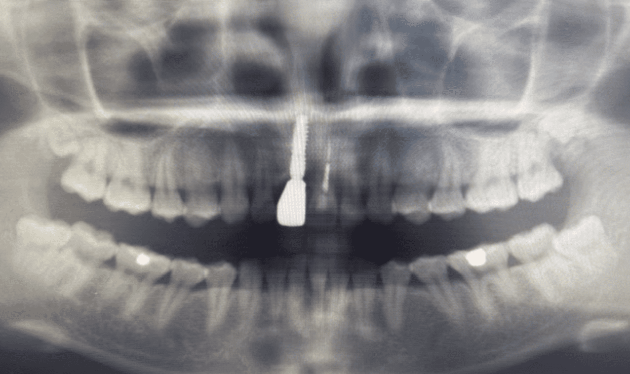 dental-xray