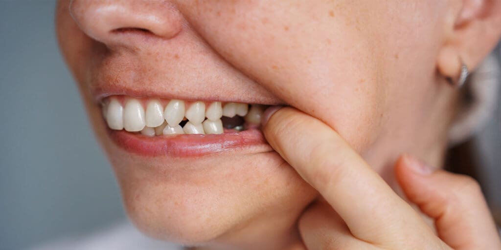 What Happens If You Don’t Replace a Missing Tooth?