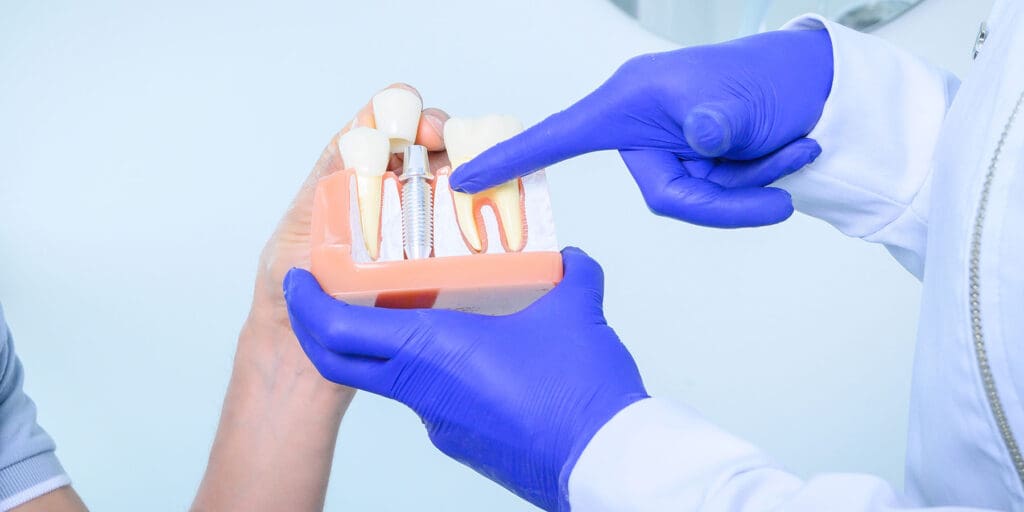 Dental Implants With Gum Disease: What You Need to Know