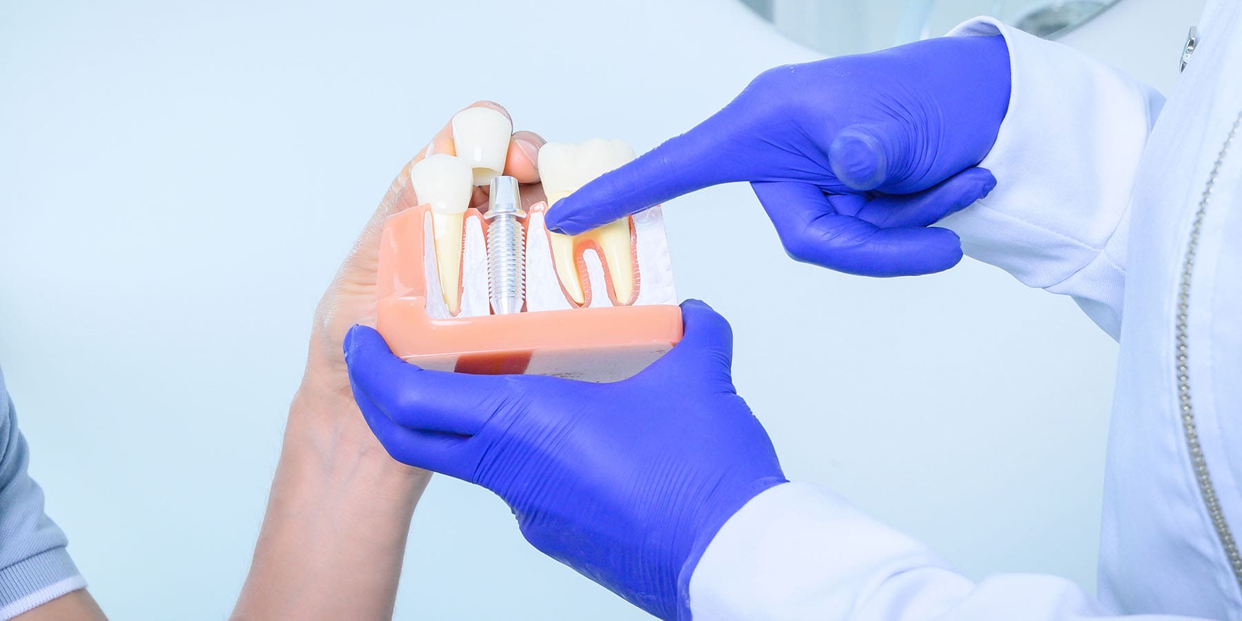 Dental Implants With Gum Disease: What You Need to Know